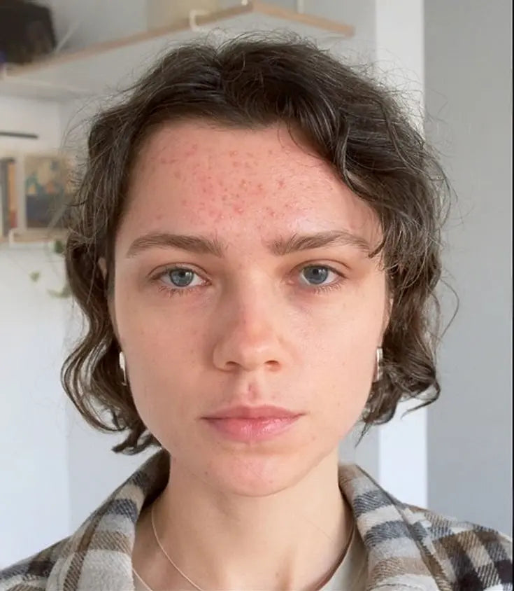Person with short brown hair and freckles looking directly at the camera.